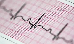 Bilim insanlarından düzensiz kalp atışını tespit eden kulaklık: 2 yıl içinde EKG'nin yerini alabilir