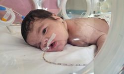 Kütahya'da bebeğin boynundan 445 gram tümör çıkarıldı