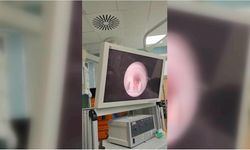 Yutkunamama şikayetiyle hastaneye götürülen çocuğun yemek borusundan et parçası çıktı