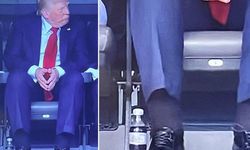 Trump’a "Kronik Venöz Yetmezlik" Teşhisi