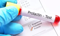 Prolaktin Hormonu: Yüksekliği ve Düşüklüğü Sağlığı Nasıl Etkiler?