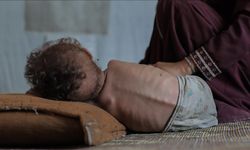 Gazze Şeridi'nde son 24 saatte 2'si çocuk 5 Filistinli daha açlıktan hayatını kaybetti