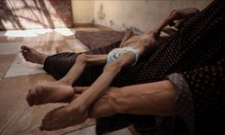 İsrail'in kıtlığı dayattığı Gazze'de son 24 saatte 3 kişi daha açlıktan hayatını kaybetti