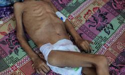 İsrail'in kıtlığı dayattığı Gazze'de son 24 saatte 3'ü çocuk 13 kişi daha açlıktan hayatını kaybetti