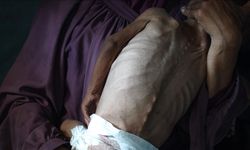 İsrail'in kıtlığı dayattığı Gazze'de son 24 saatte 1'i çocuk 6 kişi daha açlıktan hayatını kaybetti