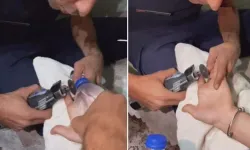 Parmağına yüzük sıkışan vatandaşı imdadına itfaiye ekipleri yetişti