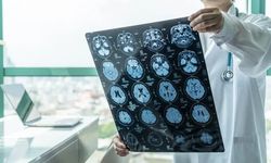 Demans hastalığının gizli nedeni şoke etti! Uzmanı açıkladı: Beynimizi yavaş yavaş öldürüyor