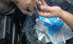 Parmakta sıkışan yüzük, hastanede doktor ve itfaiye ekibi tarafından çıkartıldı