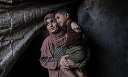 Savaşın Görünmeyen Yüzü: Gazze’de Ameliyatsız Amputasyonlar