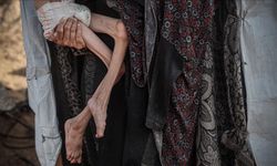 İsrail'in ablukası nedeniyle kıtlık yaşanan Gazze’de açlıktan ölenlerin sayısı 457’ye yükseldi