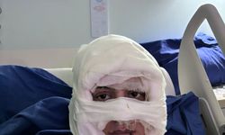 Kadıköy'de akıl almaz olay: Genç kadın başka bir kadın tarafından ateşe verildi