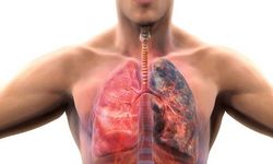 KOAH nedir? Belirtileri, nedenleri ve tedavi yöntemleri