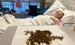 Hastadan çıkan taşları sayamadılar