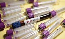 Maymun çiçeği virüsünün yeni bir türü tespit edildi