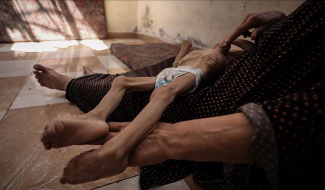 İsrail'in kıtlığı dayattığı Gazze'de son 24 saatte 3 kişi daha açlıktan hayatını kaybetti